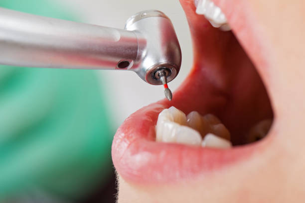 Best Dentist for Tooth Abscess  in Red Hill, SC
